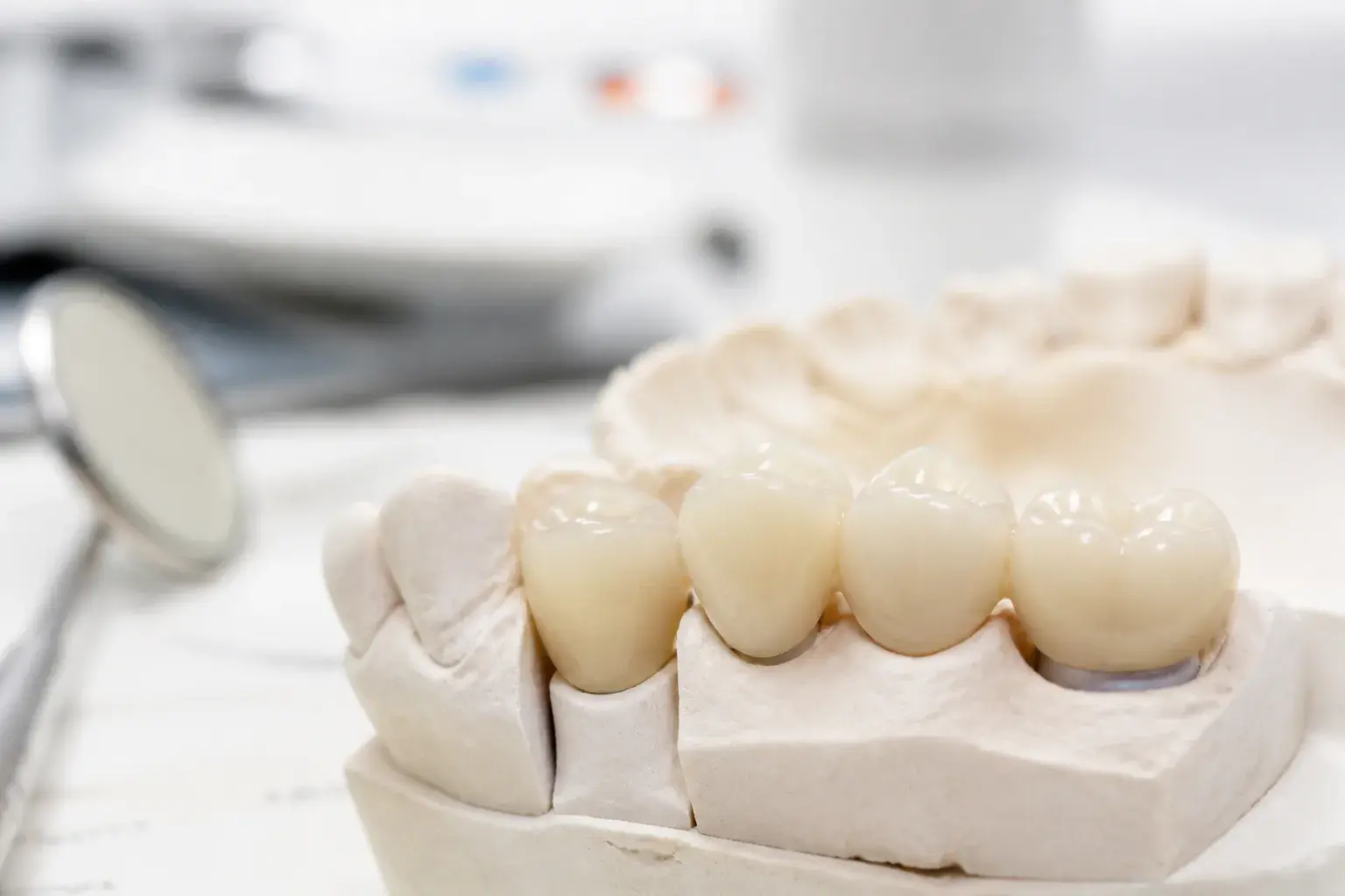 How long do dental crowns last? hero background photograph