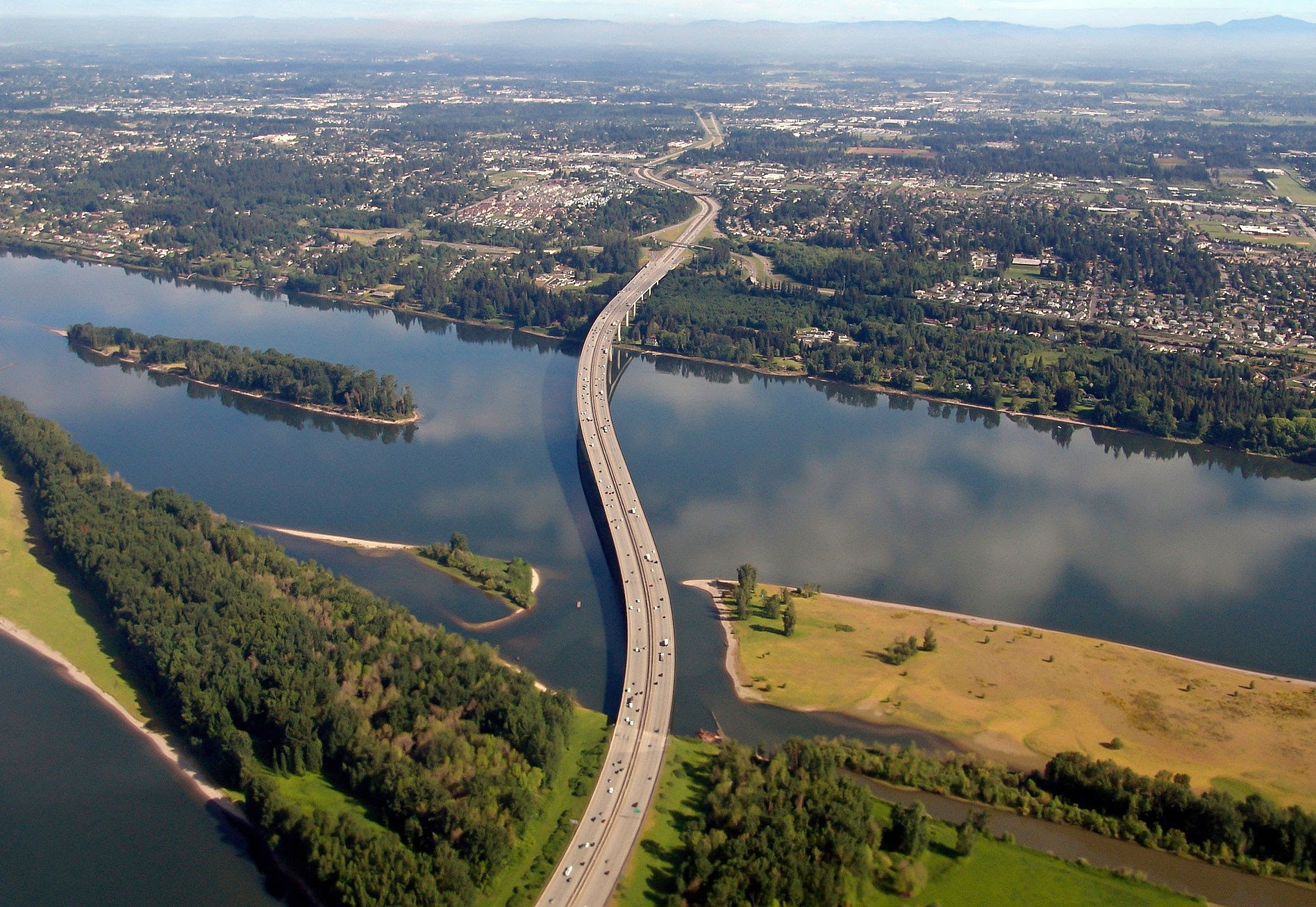 Top 5 Orthodontists in Vancouver WA