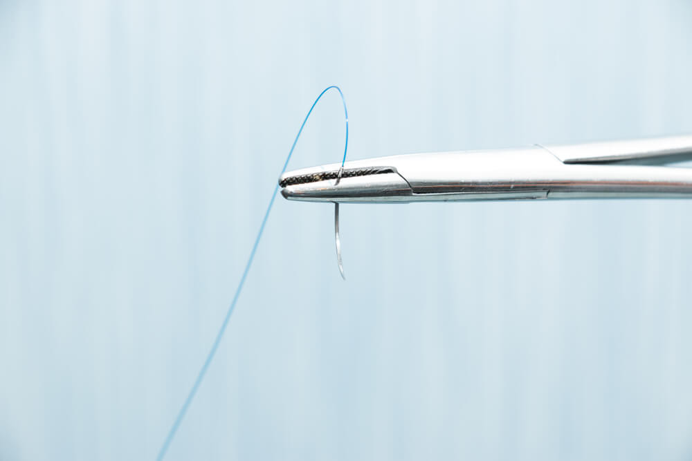 Top 10 Non-Absorbable Suture with Needles for Dentists