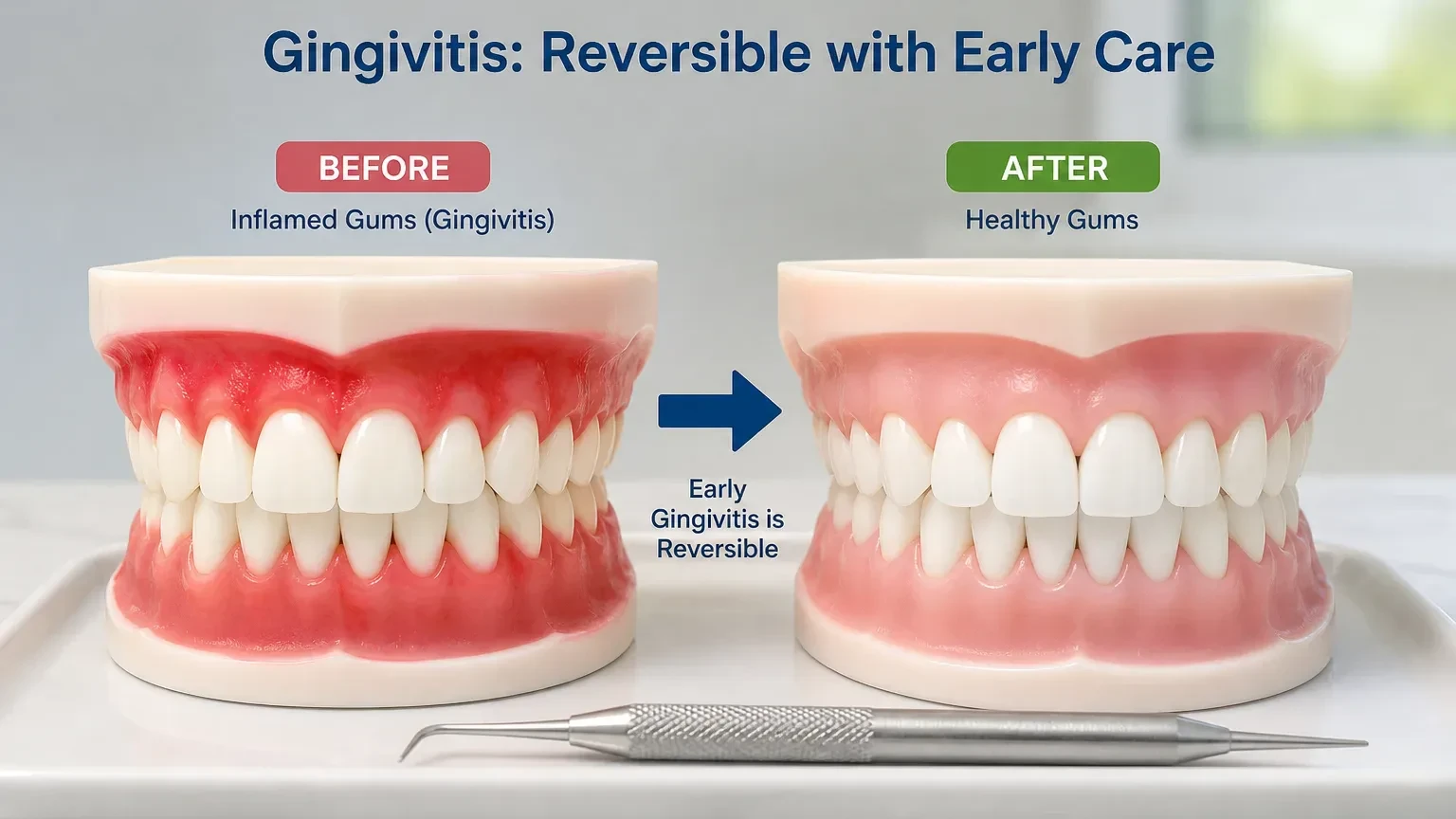Dentist explaining reversible gingivitis and controlled periodontitis with gum diagrams