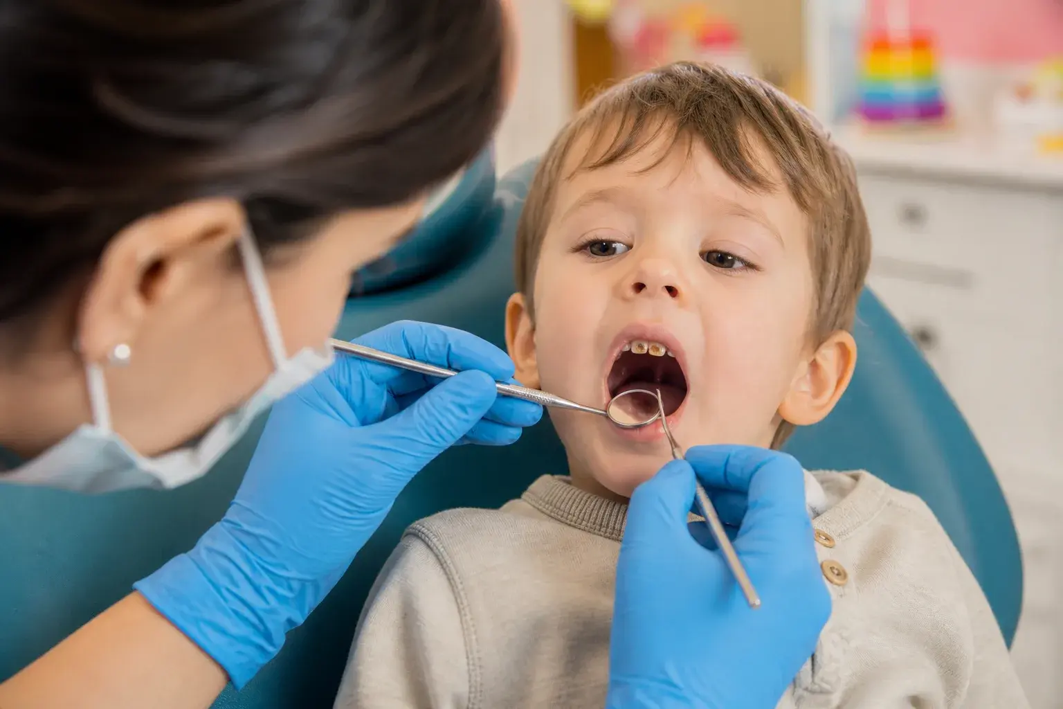 Baby bottle and toddler tooth model showing early childhood cavity risk in a pediatric clinic