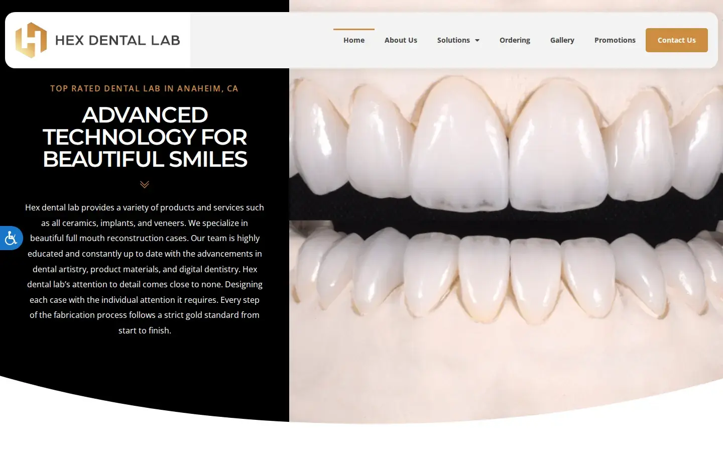 Homepage preview of Hex Dental Lab