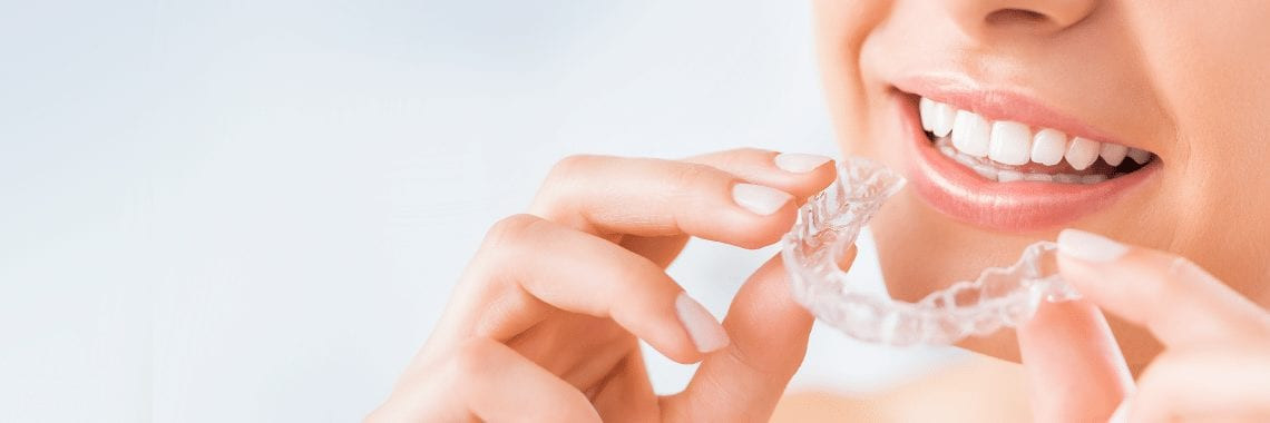 Braces and Your Smile: Today’s Options