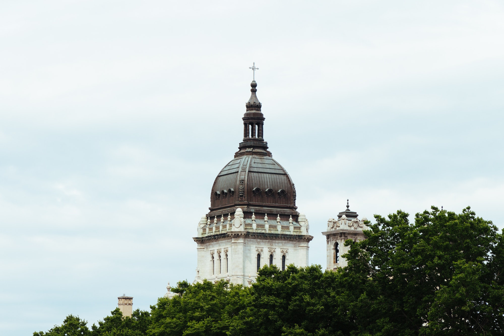 Top 5 Cosmetic Dentists in Minneapolis MN