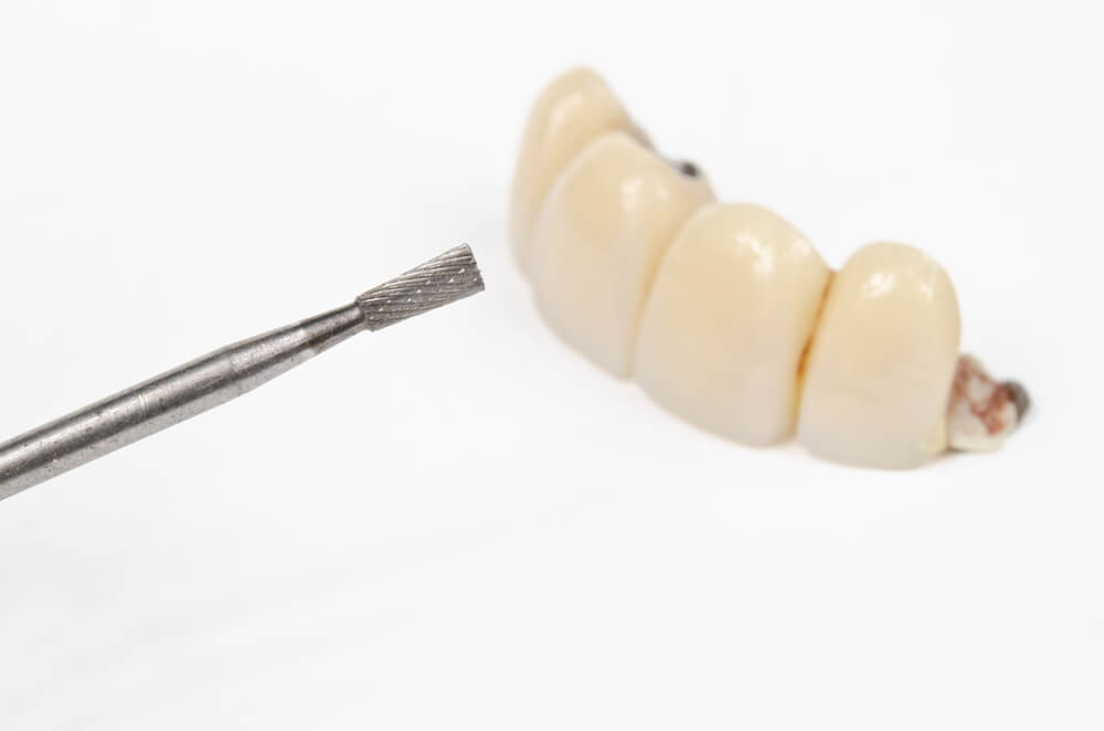 Top 10 Dental Diamond Burs for Dentists