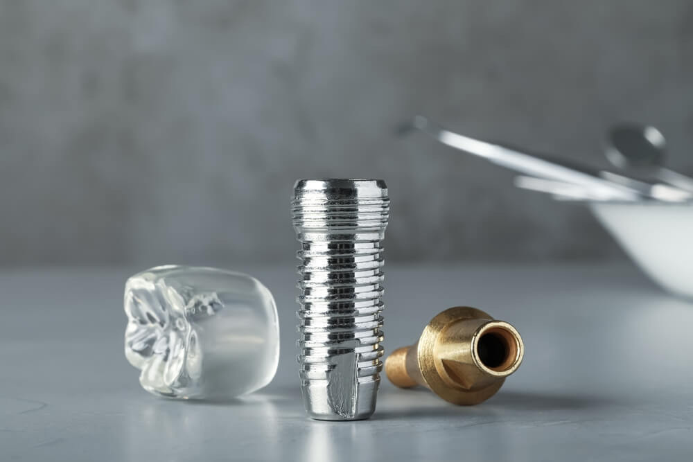 Top 10 Dental Implant Abutments