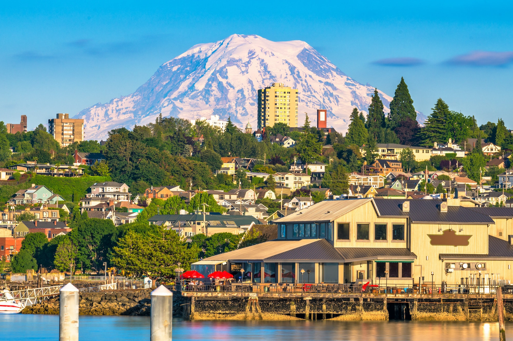 Top 5 Endodontists in Tacoma WA