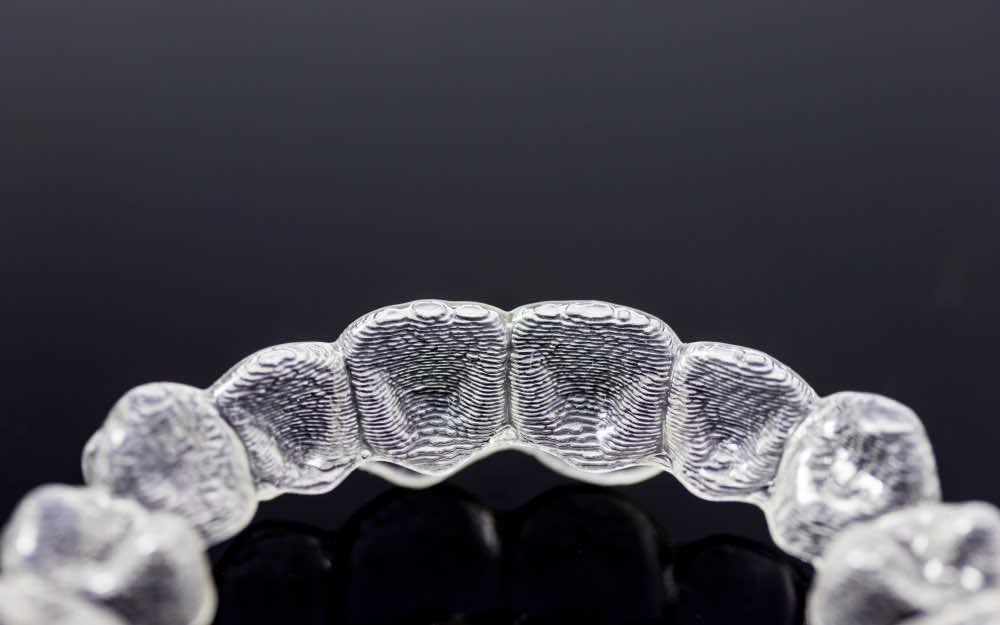 What happens if you lose a clear aligner? Dental Country FAQ