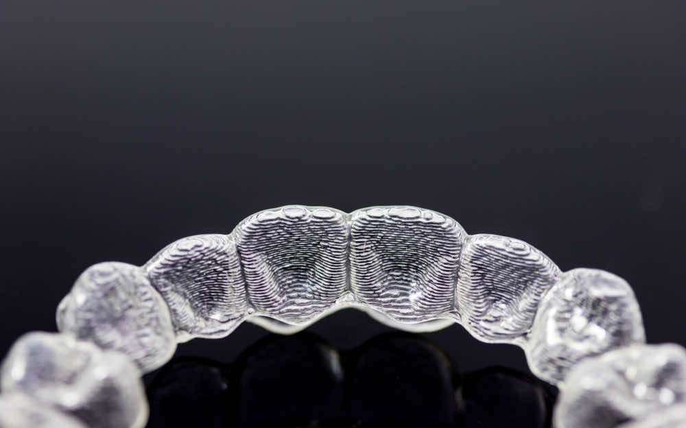 Can I smoke while wearing clear aligners?