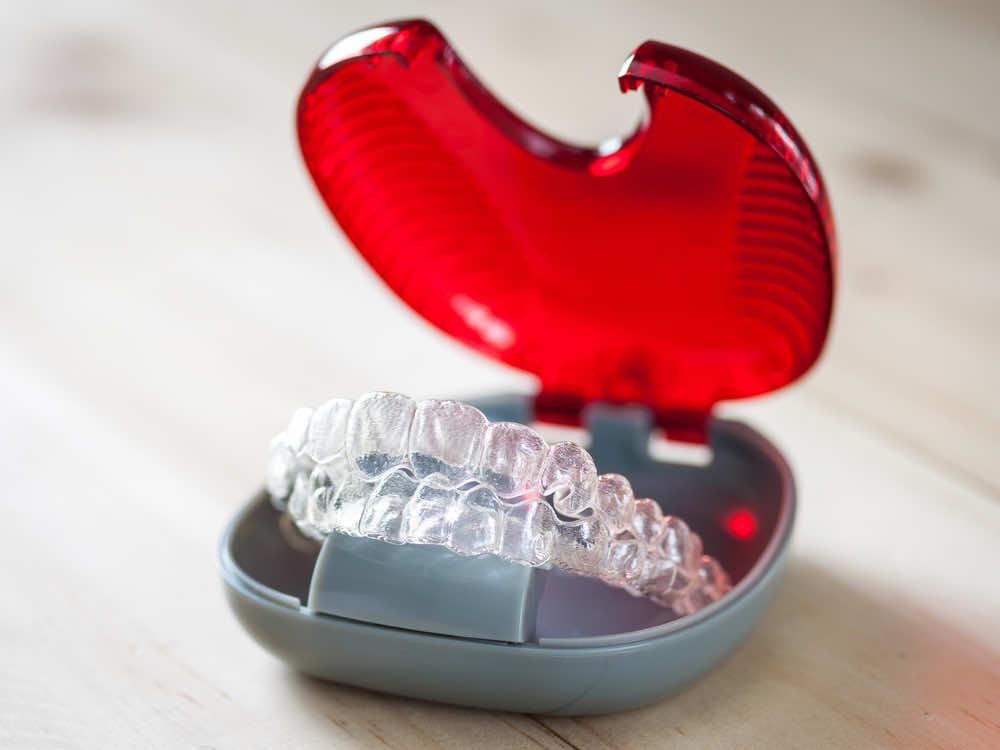 Are There Any Age Restrictions For Using Clear Aligners?