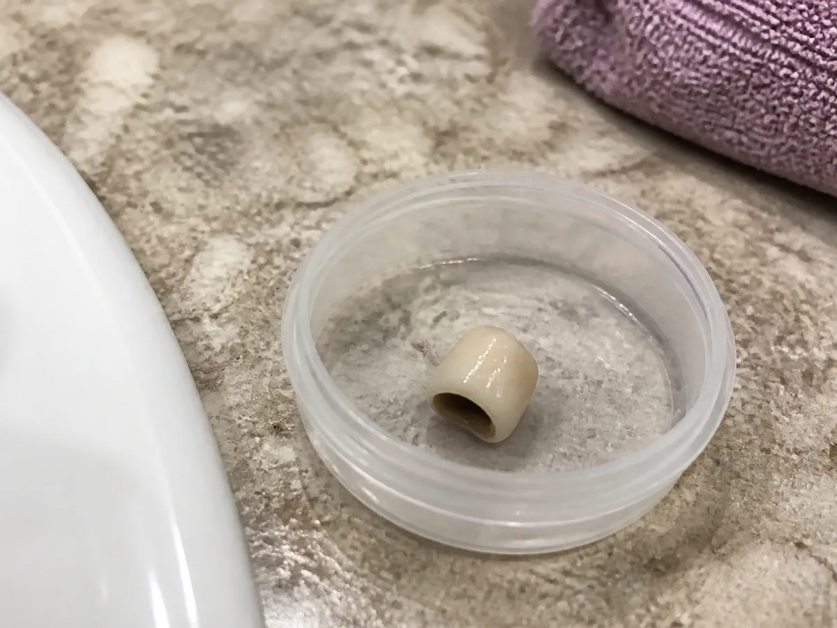 Patient placing a fallen dental crown in a small labeled container