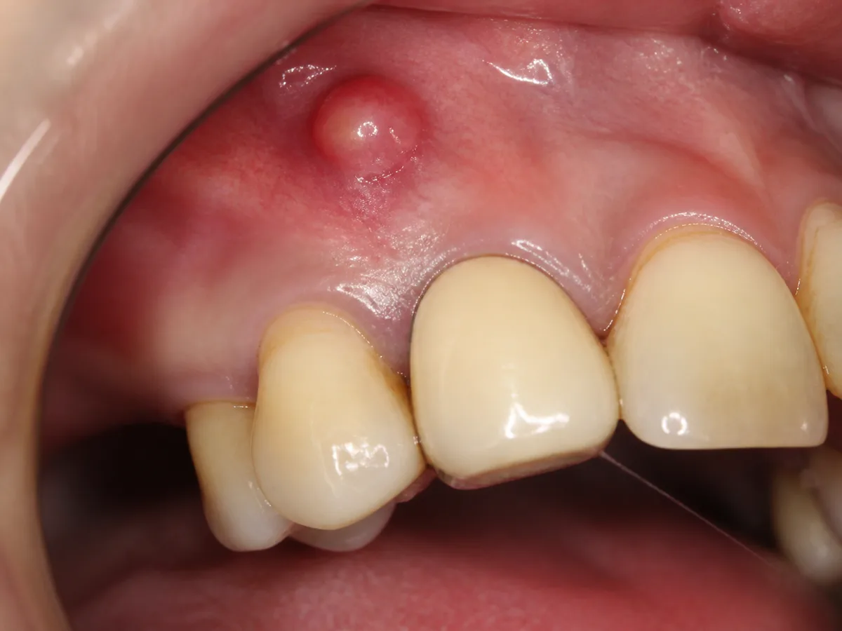 Patient talks with an endodontist about retreatment choices