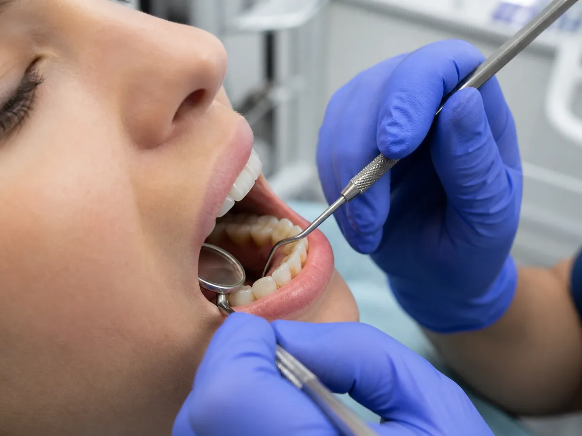 Tongue checking the smooth tooth surface after tartar removal at a cleaning