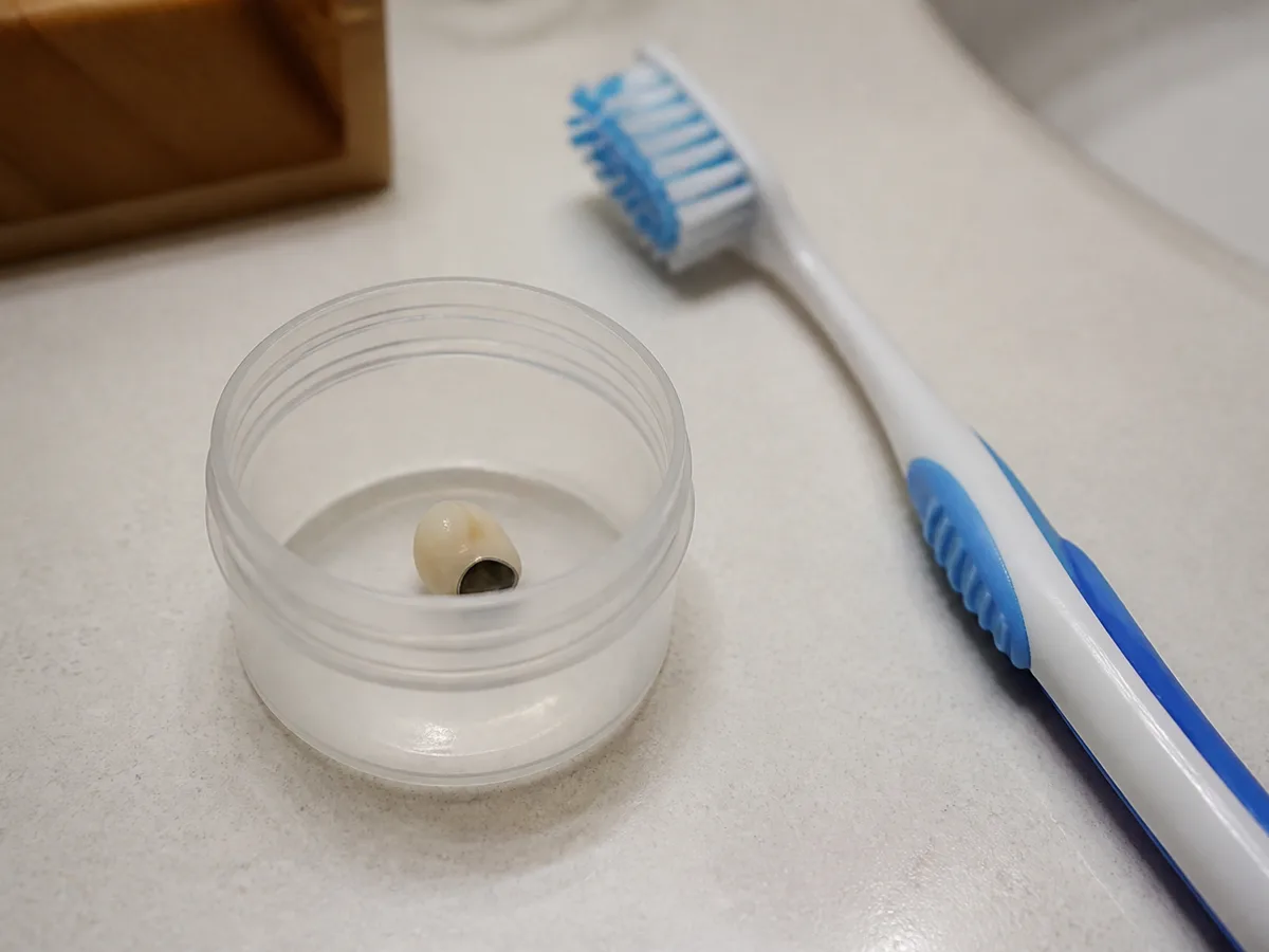 Patient placing a fallen dental crown into a clean container
