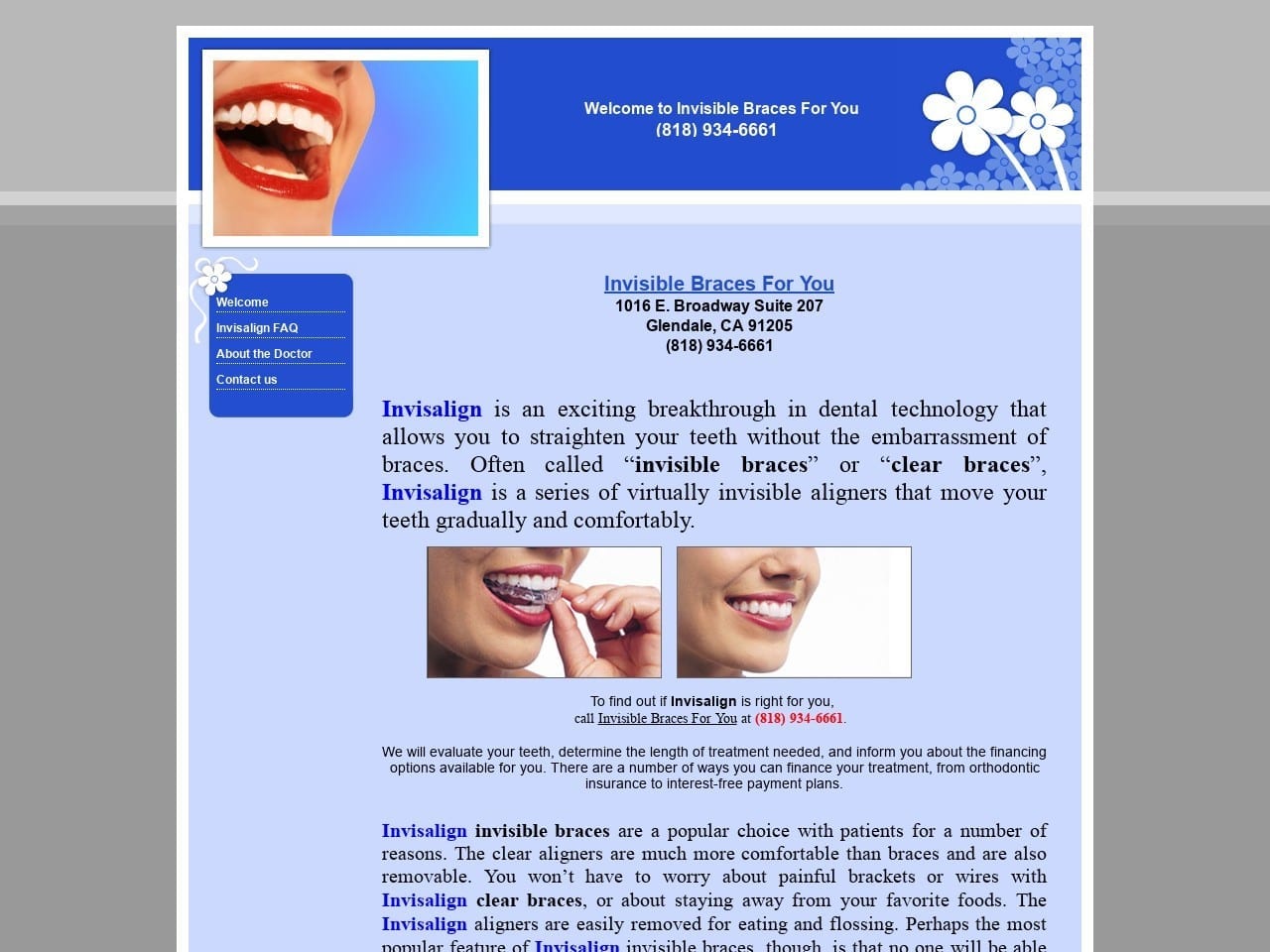 Invisible Braces For You Website Screenshot from invisiblebraces4u.com