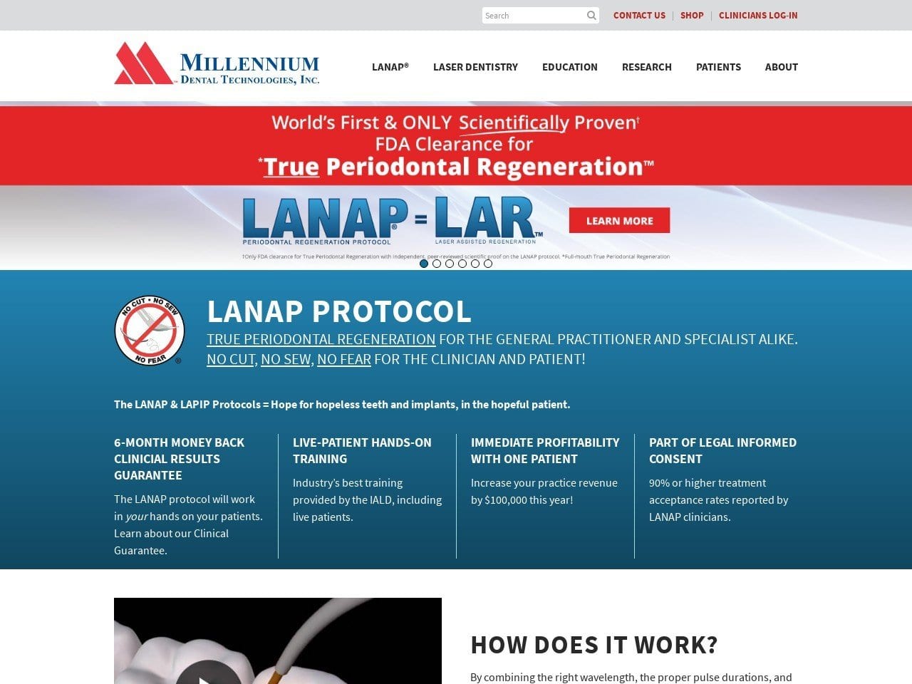 Millennium Dental Technologies Website Screenshot from lanap.com