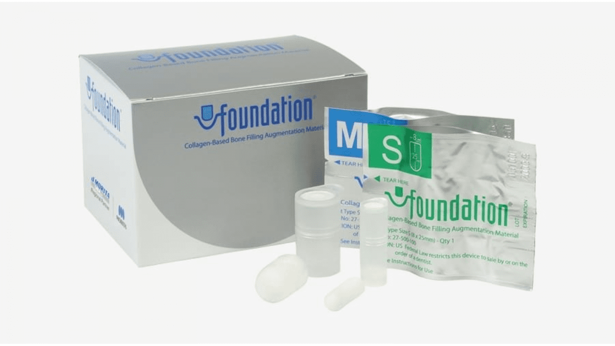 Foundation Bone Filling Material