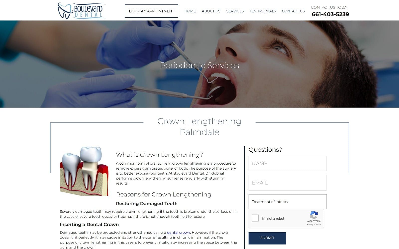 The screenshot of boulevard dental dentistpalmdale. Com website