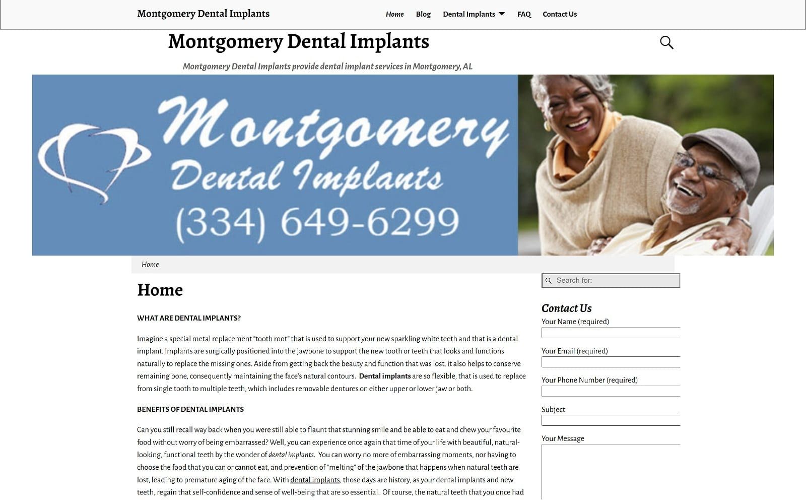 The screenshot of montgomery dental implants montgomerydentalimplants. Com website