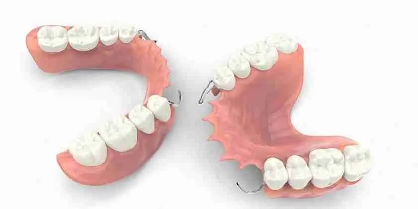 Removable Dentures