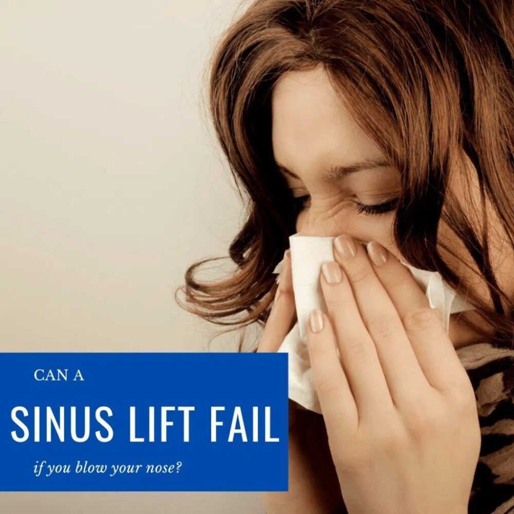 Sinus Lift Fail