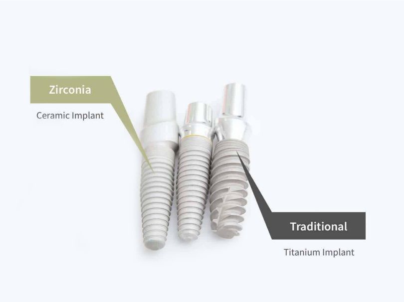 Zirconia vs. Ceramic Implant