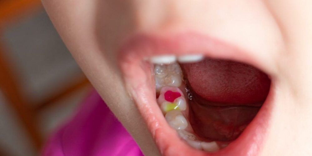 child pink tooth