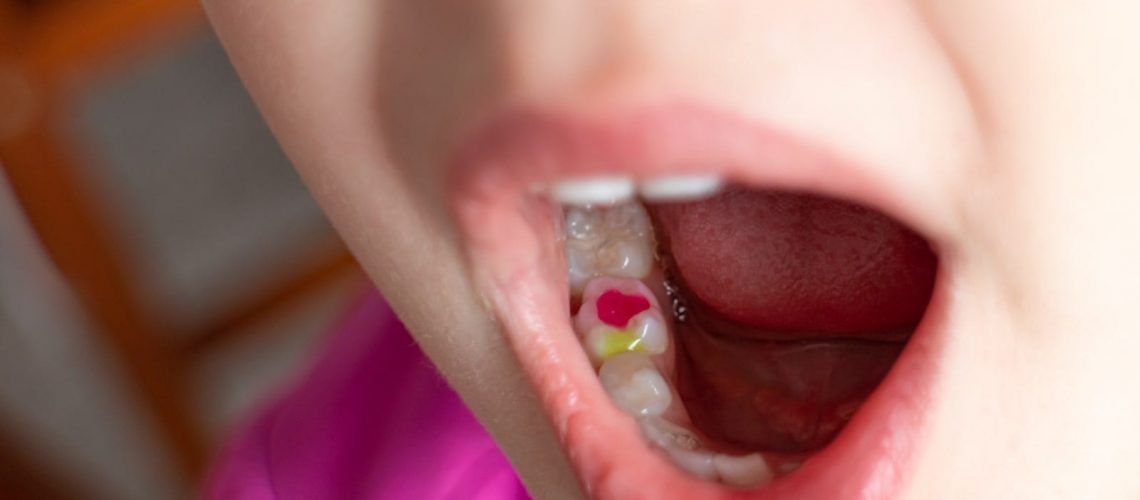 child pink tooth