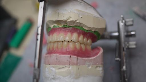 try in set dentures