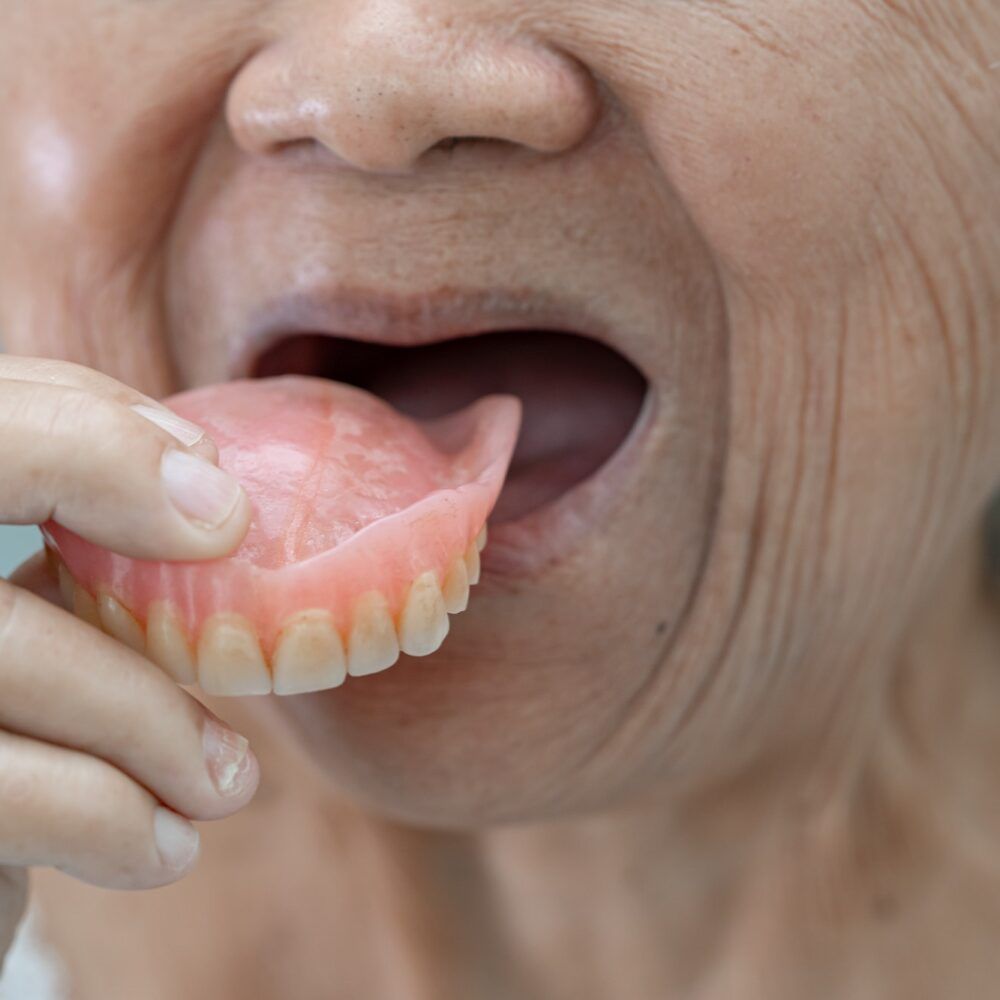 Asian senior woman patient holding to use denture.