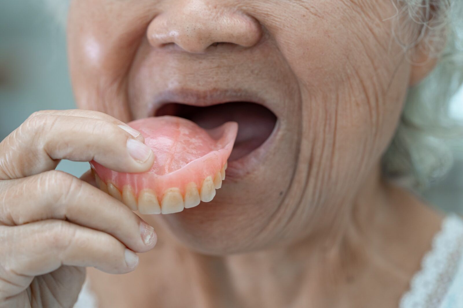 Asian senior woman patient holding to use denture.