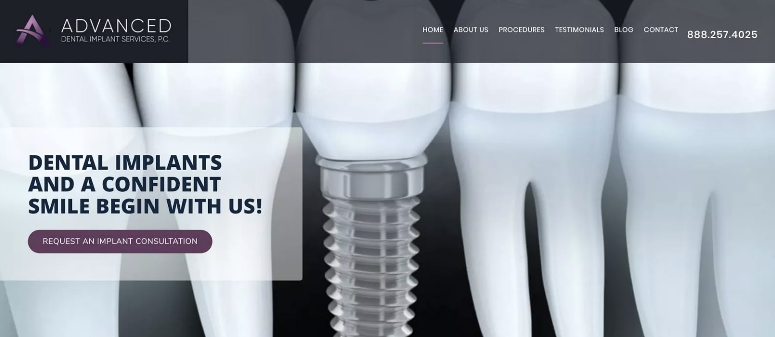 Dental implants placed by a surgeon