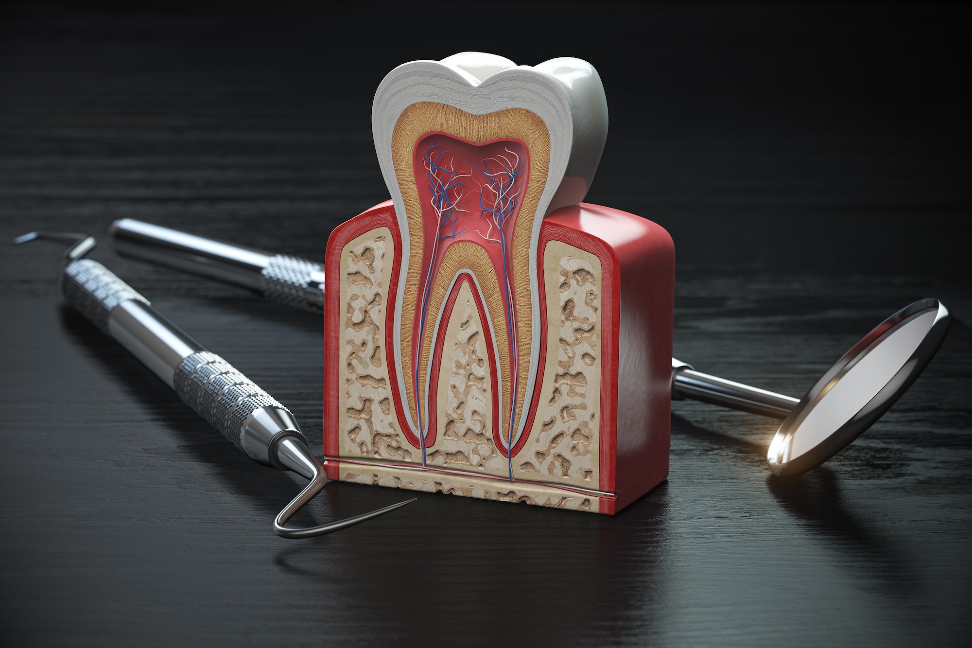 Tooth model cross section with dental tools on black wooden tabl