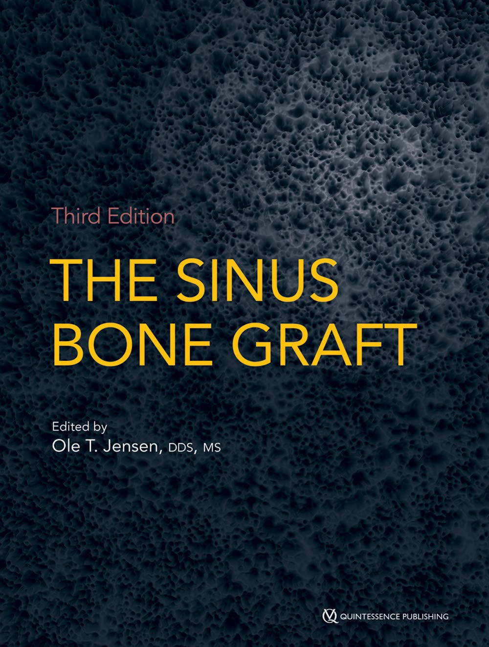The sinus bone graft book cover