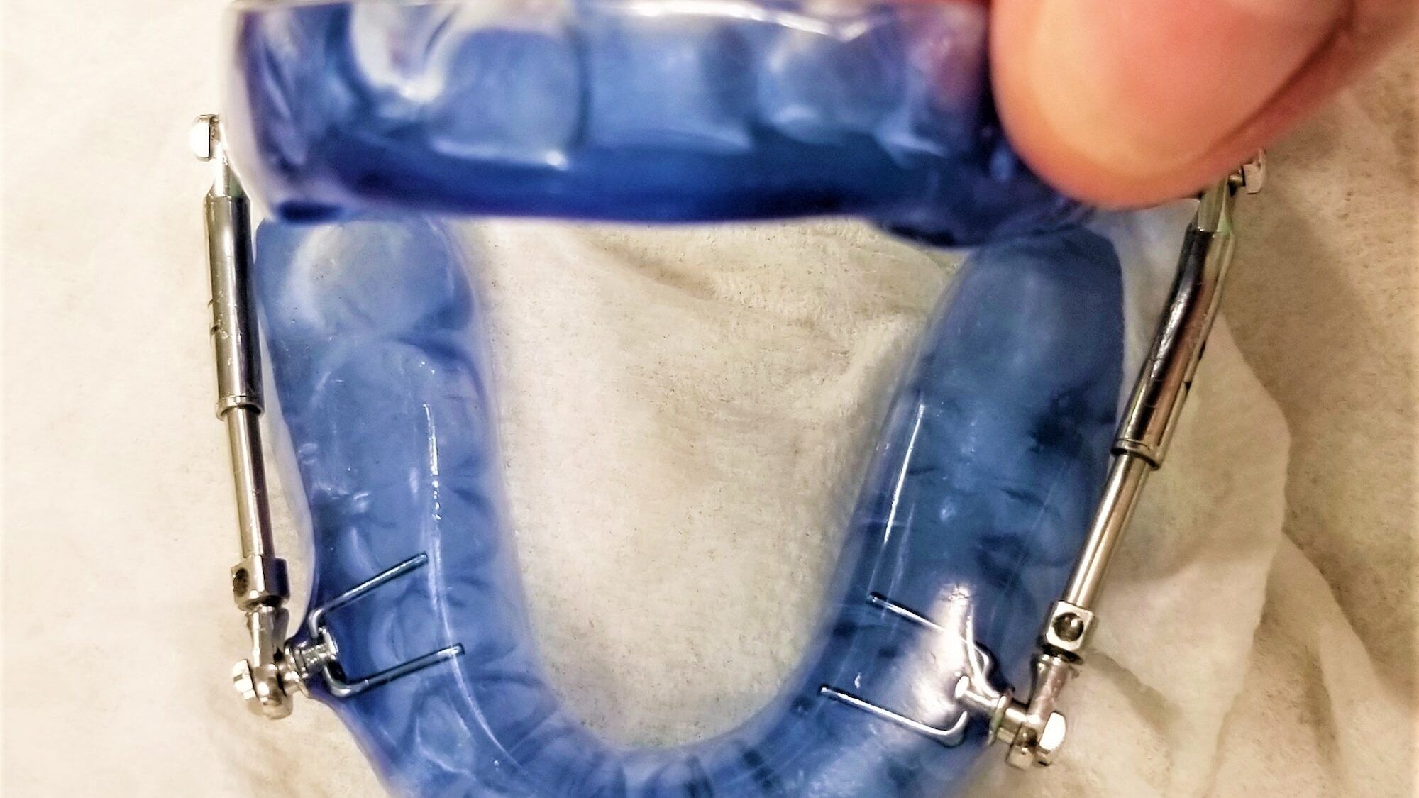 Oral care! Mandibular device for sleep apnea!!