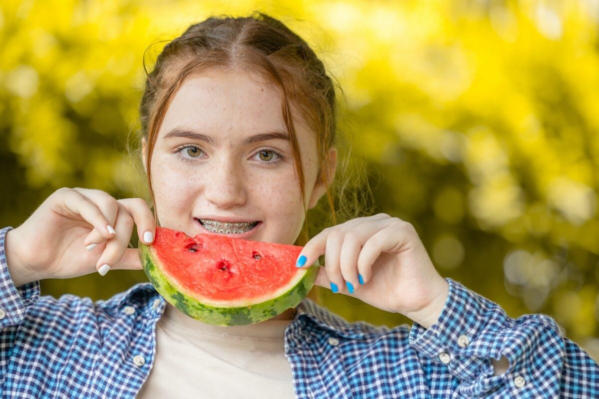 beautiful teen girl smiling with watermelon and dental care orthodontic treatment teeth aligning w