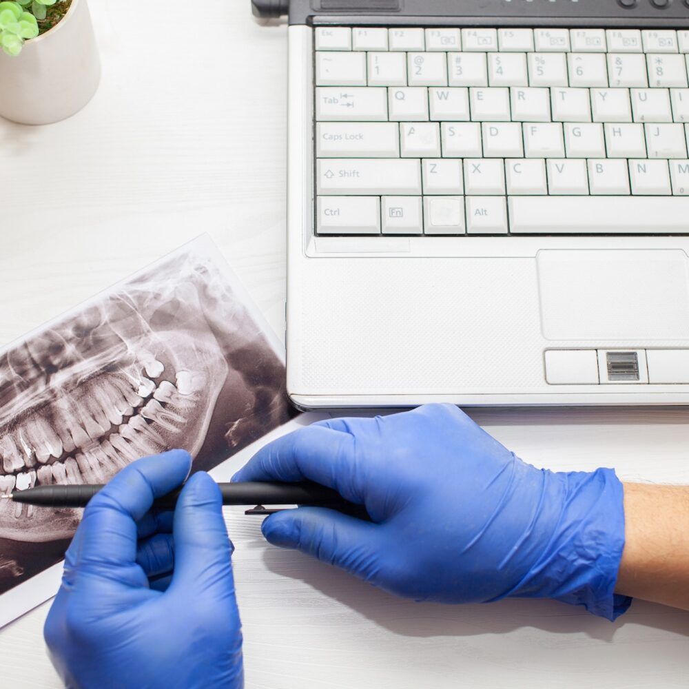 dentist in clinic examines x-ray of jaw of client's patient's wisdom teeth. modern technologies