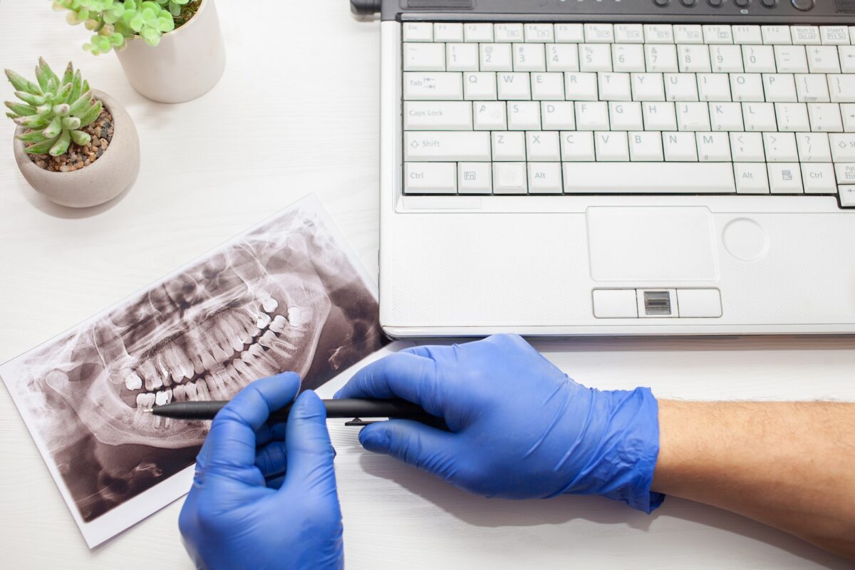 dentist in clinic examines x-ray of jaw of client's patient's wisdom teeth. modern technologies