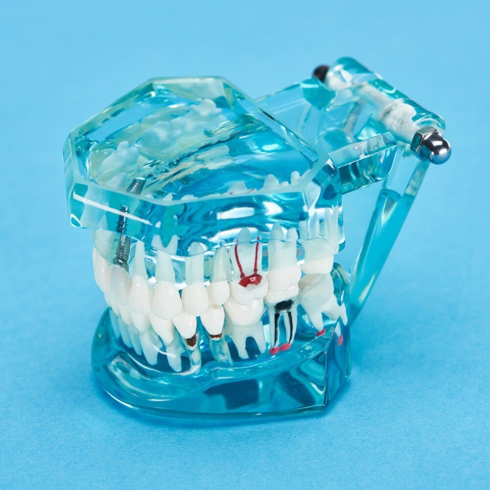 teeth model with red dental roots in white teeth on blue