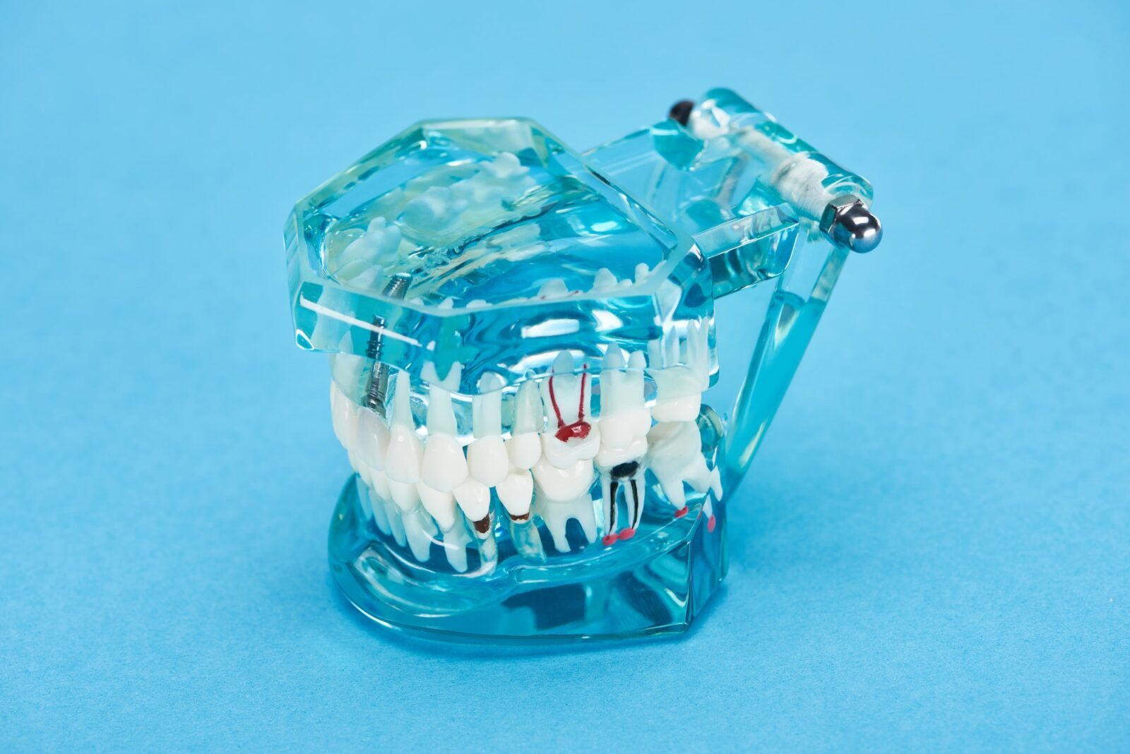 teeth model with red dental roots in white teeth on blue