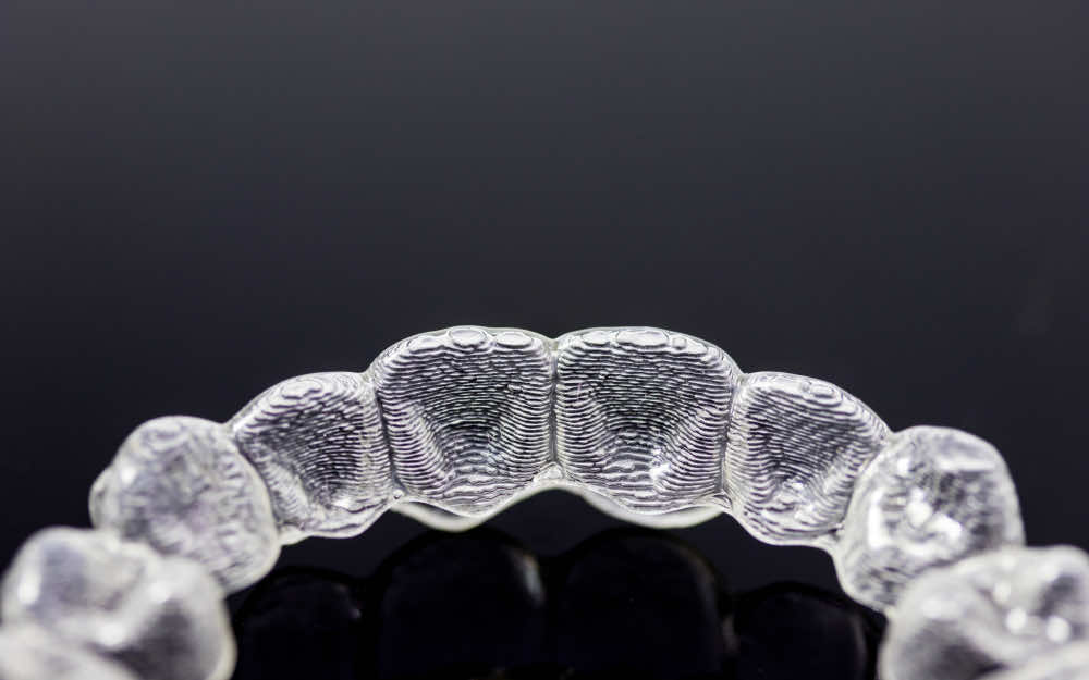 close up a clear aligner